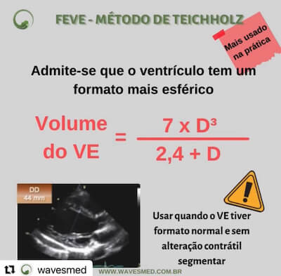 Fração de Ejeção VE Wavesmed<br />  Teicholz<br />  Curso preparatorio para prova de título de ecocardiograma Wavesmed