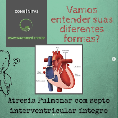 Atresia pulmonar com septo interrventricular íntegro Wavesmed  Curso preparatório para a prova de título de ecocardiografia