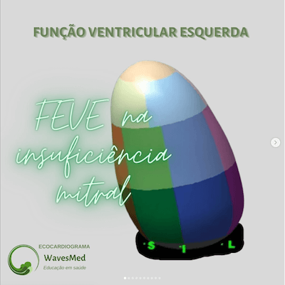 Função do ventrículo esquerdo no paciente com insuficiência mitral Wavesmed