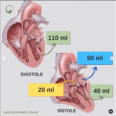 Função do ventrículo esquerdo no paciente com insuficiência mitral Wavesmed  Regurgitação mitral