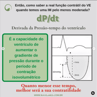 Função do ventrículo esquerdo no paciente com insuficiência mitral Wavesmed  DP/DT