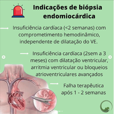 Indicações de biópsina endomiocárdica Miocardite Wavesmed