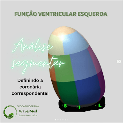 Função ventricular esquerda ecocardiograma<br />  Análise coronária correspondente