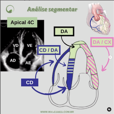 Função ventricular esquerda ecocardiograma<br />  Análise coronária correspondente<br />  Apical 4C