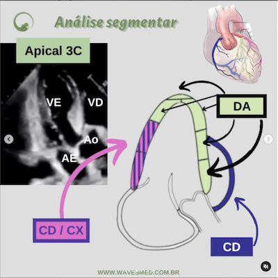 Função ventricular esquerda ecocardiograma<br />  Análise coronária correspondente<br />  Apical 3C