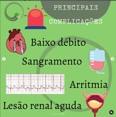 Pós operatório de cirurgia cardíaca pediátrica Wavesmed<br />  Principais complicações