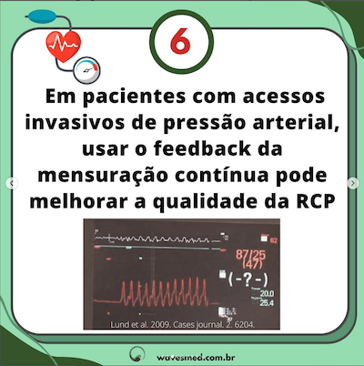 Pressão arterial invasiva<br />  Atualizações PALS Parte 2 Wavesmed