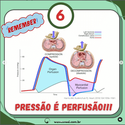 Pressão é perfusão<br />  Atualizações PALS Parte 2 Wavesmed