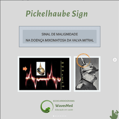 Pickelhaube Sign Wavesmed