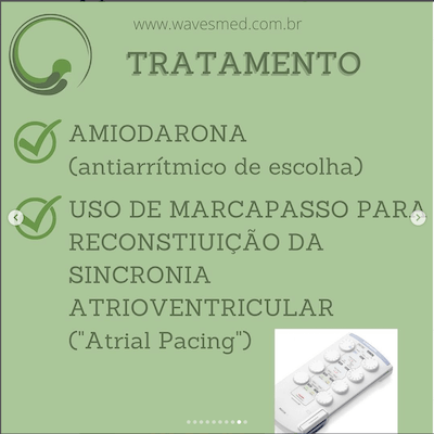 Tratamento medicamentoso JET Taquicardia Juncional Ectópica Wavesmed