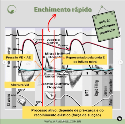 Enchimento rápido Função diastólica Wavesmed