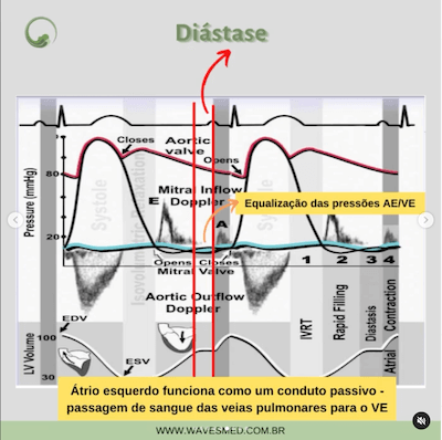 Diástase Função diastólica Wavesmed