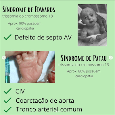 Edwards Genética na Cardiopatia Congênita Wavesmed