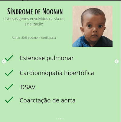 Noonan Genética na Cardiopatia Congênita Wavesmed