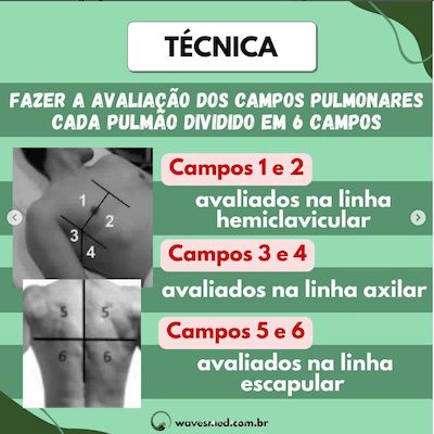 tecnica-campos-pulmoncare-ultrassom-UTI-wavesmed