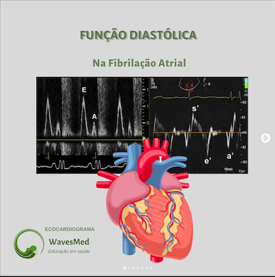 Funcao diastolica fibrilacao atrial wavesmed