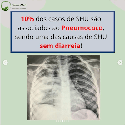 pneumococo sindrome hemolitico uremica wavesmed