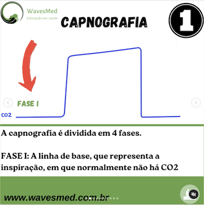 Fase 1 capnografia Wavesmed