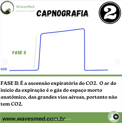 Fase 2 capnografia Wavesmed