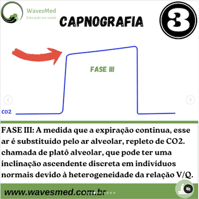 Fase 3 Expiração Continua Capnografia Wavesmed