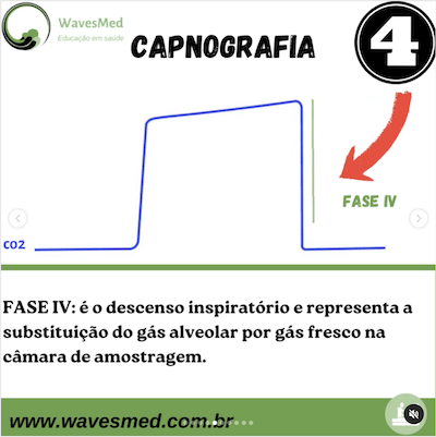 Fase 4 Descenso Inspiratório Capnografia Wavesmed