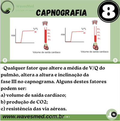 Fatores que alteram Capnografia Capnografia Wavesmed