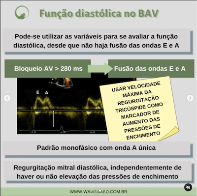 BAV Função Diastólica BAV marcapasso Wavesmed