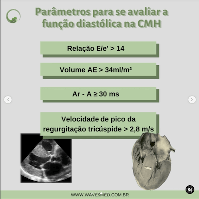 Parâmetros avaliação função diastólica cardiomiopatia hipertrófica wavesmed